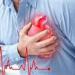 الزحام المروري قد يزيد من خطر الإصابة بأمراض القلب والأوعية الدموية | دراسة - مصر النهاردة