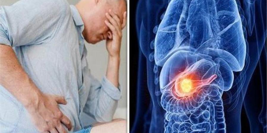 عوامل خطر تسبب سرطان البنكرياس.. أشهر الأعراض - مصر النهاردة